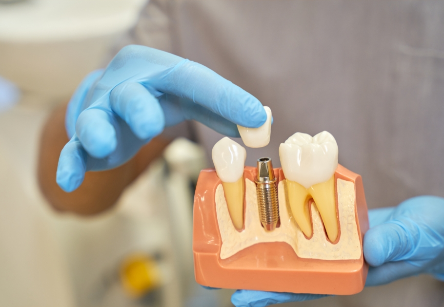 Clínica dental en La Dehesa 3 - Clínica Dental Laura Vázquez