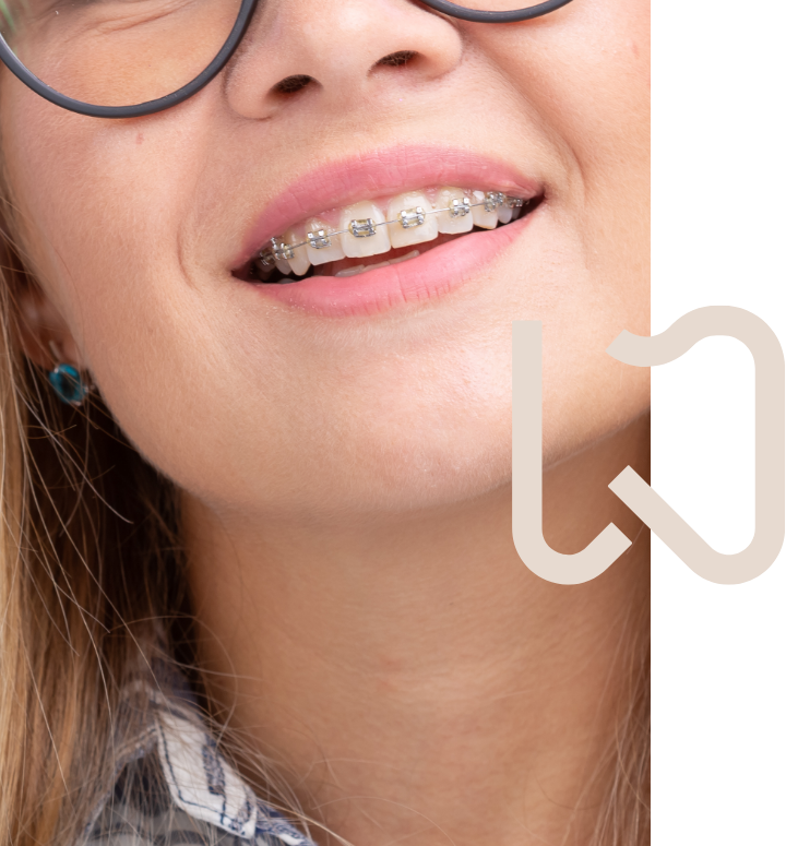 Ortodoncia brackets 2 - Clínica Dental Laura Vázquez