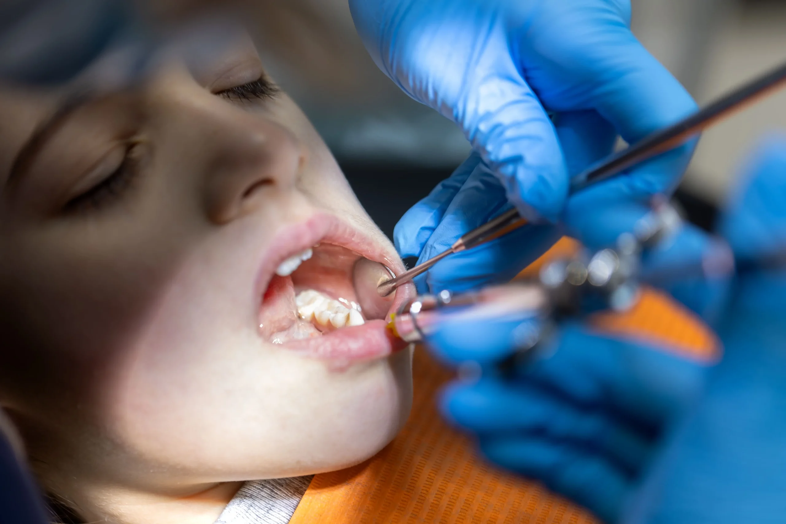 Causas Y Consecuencias De Las Caries en aljaraque huelva corrales laura vazquez